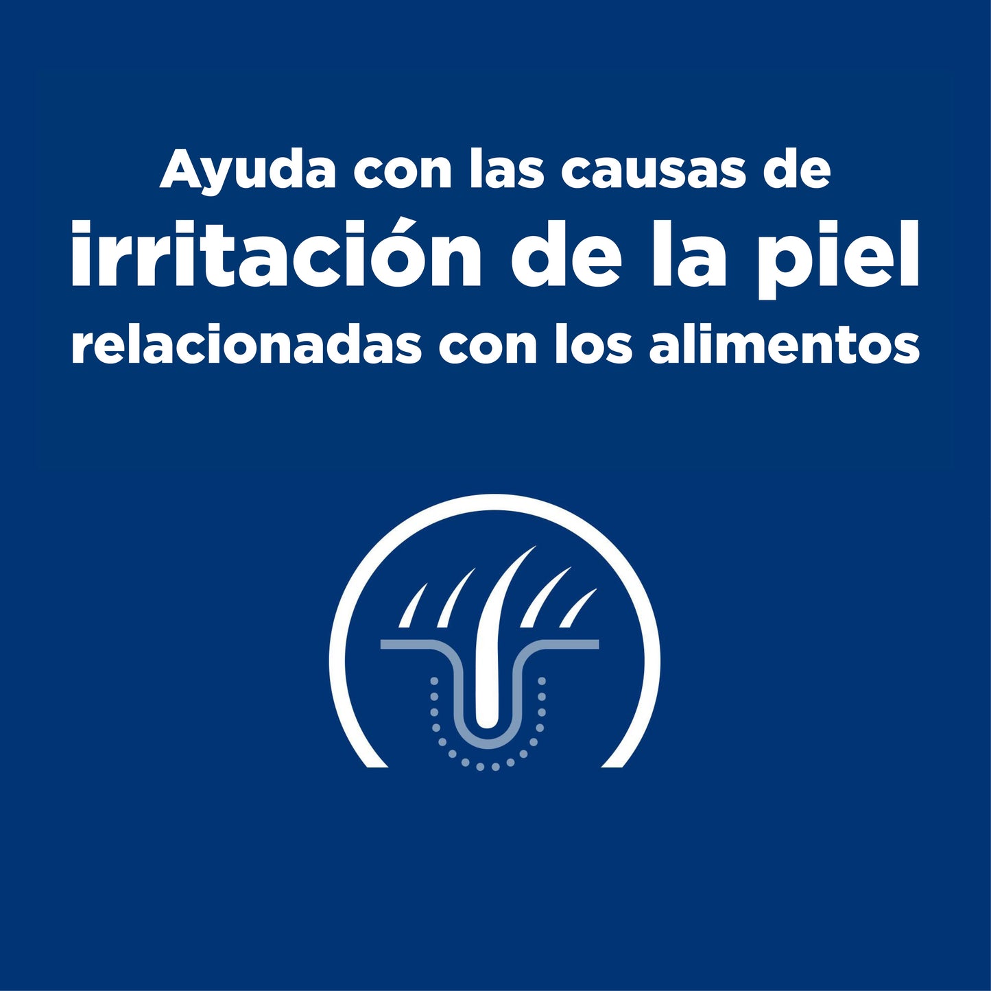 Hills Science Diet Alimento Perros z/d Ultra Alergia Alimentaria Pienso zd